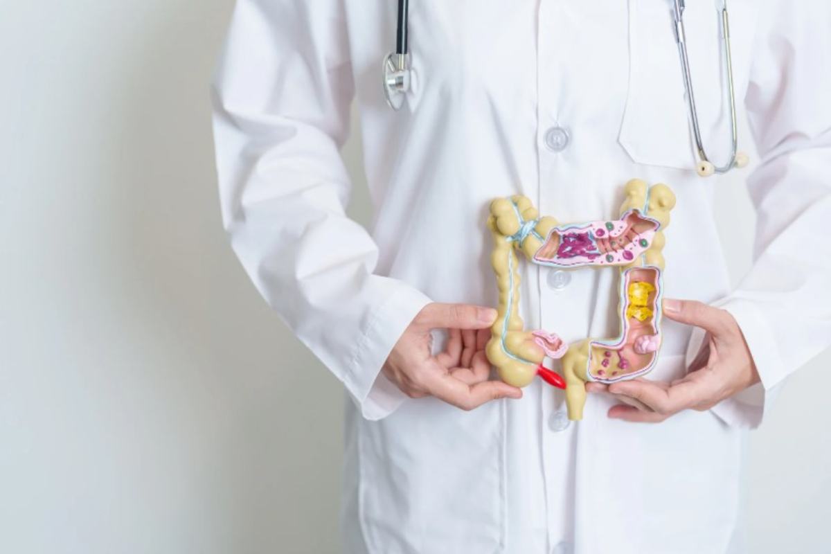 Prevenzione tumore colon